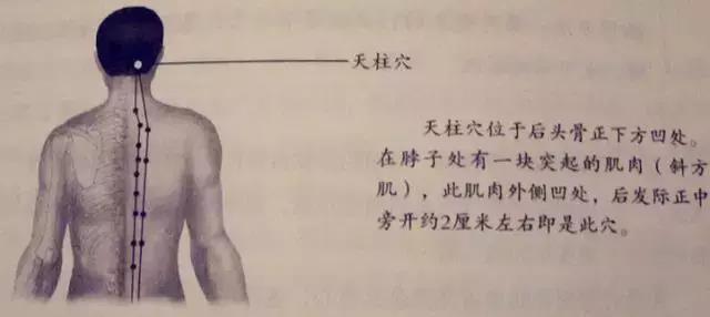 天柱穴