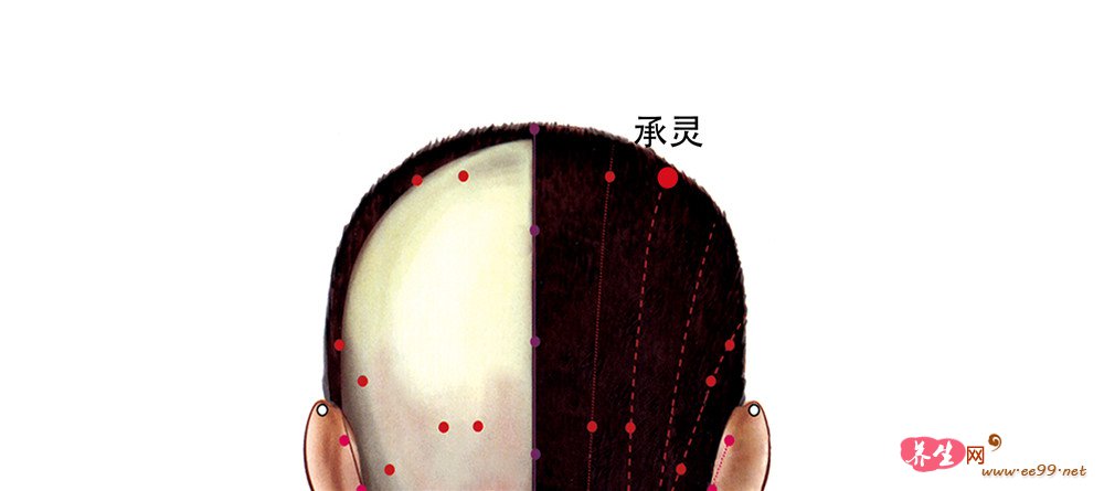 承灵穴位置图