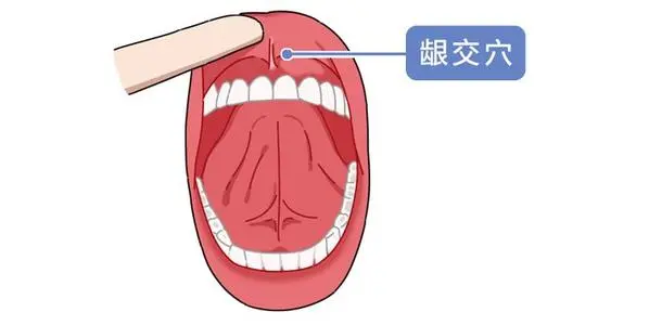 龈交穴位置图
