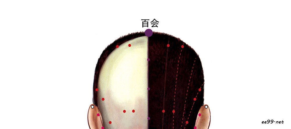 百会穴位置图