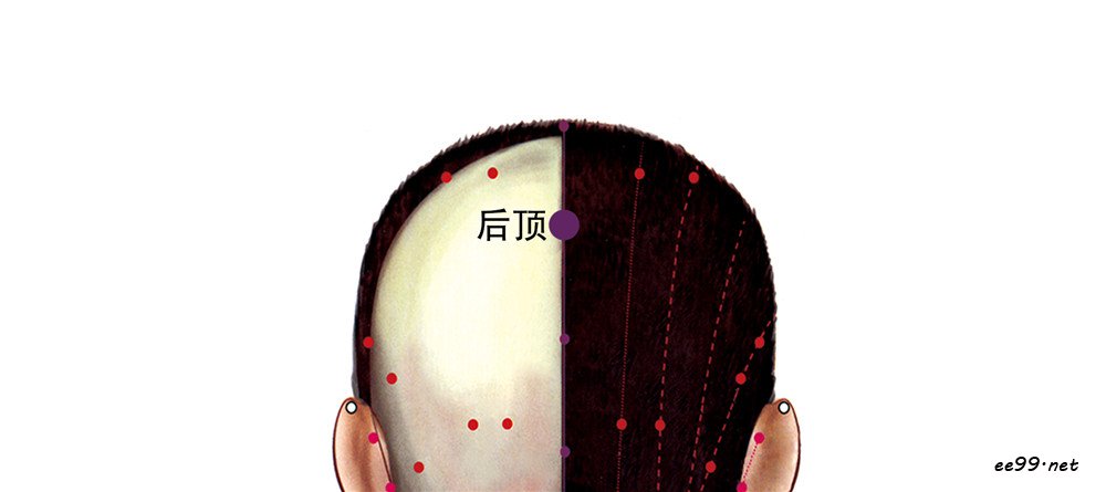 后顶穴位置图