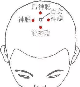 四神聪穴位置图