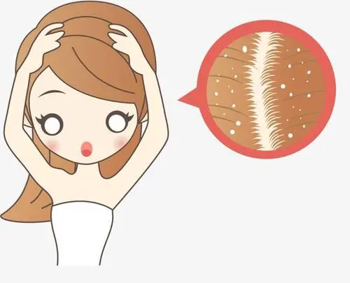头皮屑,头皮屑的治疗方法,头皮屑偏方