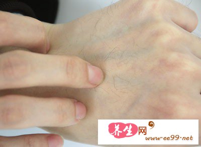 在出现皮肤过敏之后,更要注意睡眠了 在出现皮肤过敏之后,更要注意睡眠了